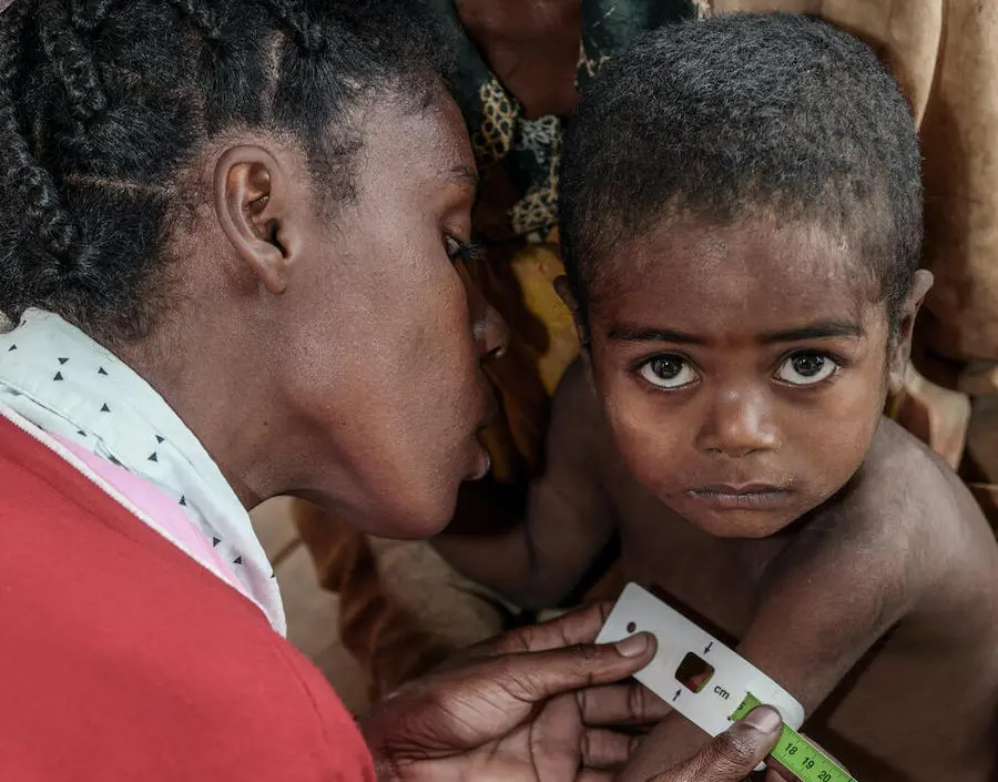 A health worker measures the arm circumference of 3-year-old Mara at the UNICEF-supported Ambohimalaza Basic Health Center in Ambovombe, Androy Region, Madagascar. A health worker measures the arm circumference of 3-year-old Mara at the UNICEF-supported Ambohimalaza Basic Health Center in Ambovombe, Androy Region, Madagascar.