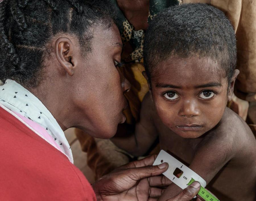 A health worker measures the arm circumference of 3-year-old Mara at the UNICEF-supported Ambohimalaza Basic Health Center in Ambovombe, Androy Region, Madagascar.