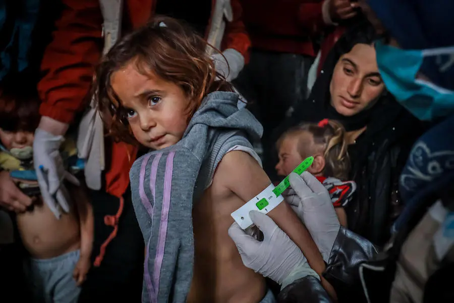 A UNICEF-supported health worker measures a child's mid-upper arm to screen for malnutrition at a site for families displaced by violence in Hasakah city, northeast Syria on January 24, 2022. A UNICEF-supported health worker measures a child's mid-upper arm to screen for malnutrition at a site for families displaced by violence in Hasakah city, northeast Syria on January 24, 2022.