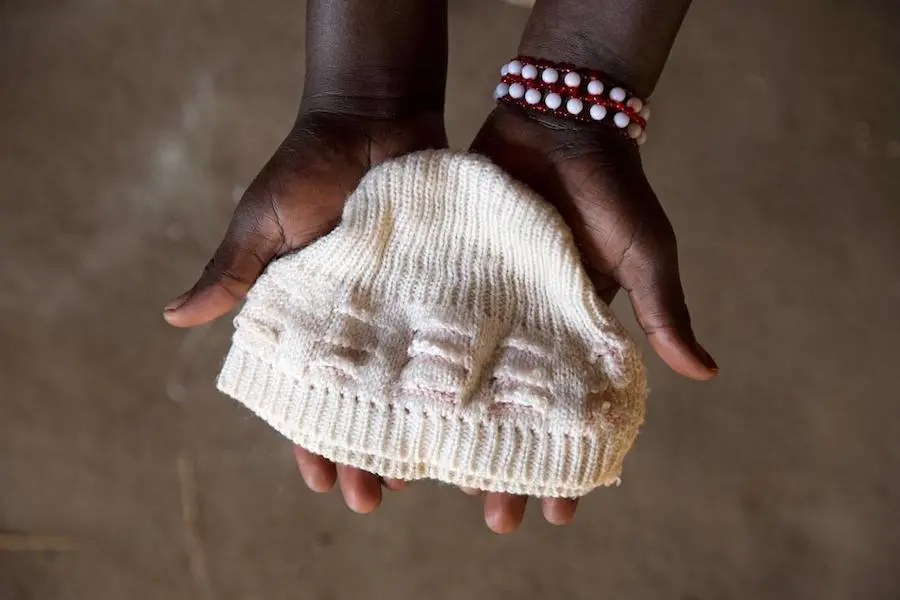 Agnes holds her baby boy's knitted hat in Bidi Bidi refugee settlement in northwestern Uganda in 2017. Agnes fled conflict South Sudan with her infant son. Unfortunately, he contracted malaria on the journey and died days after their arrival at Bidi Bidi. UNICEF, Uganda, Bidi Bidi, refugees, South Sudan