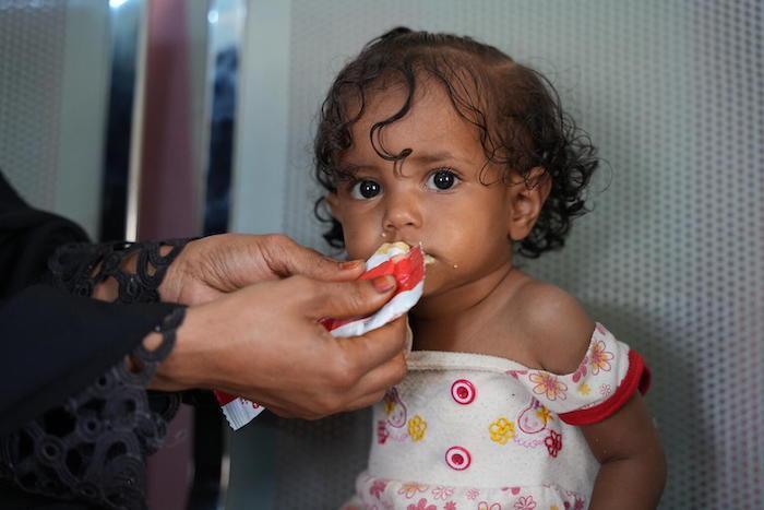 A child suffering from severe acute malnutrition is fed ready-to-use-therapeutic food (RUTF) at a health facility in Yemen
