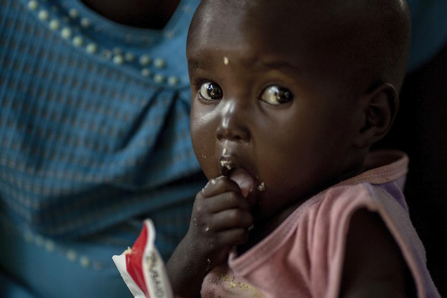 Ahok Deng, 20 months old, had measles, she could not eat and was very sick. At 20 months her weight stands at 5.6 kg. There has been an unprecedented outbreak of measles around Tharkueng village. While Ahok is being treated at the nutrition center (OTP) f
