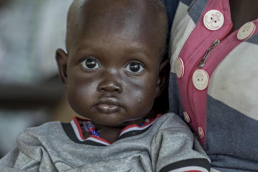 Child at UNICEF-supported Al-Sabah hospital, stabilization center for severe acute malnourished children in Juba, the capital of South Sudan in 2019.