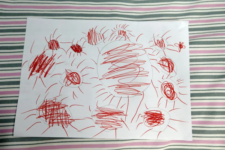 A painting drawn by 5-year-old Yuanyuan depicts the sun in the center surrounded by viruses in a hospital affiliated with Wuhan University of Science and Technology in China in February 2020. “These are viruses. The sun is scorching them,” she says.