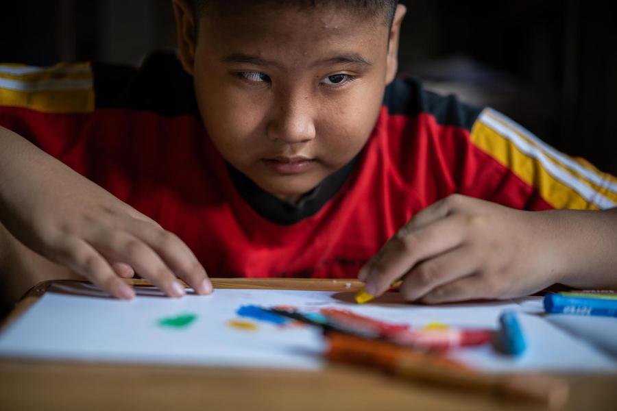 Kevin, 9, a child with a visual impairment, draws with a crayon in his room at home in Banyumas, Central Java, Indonesia.