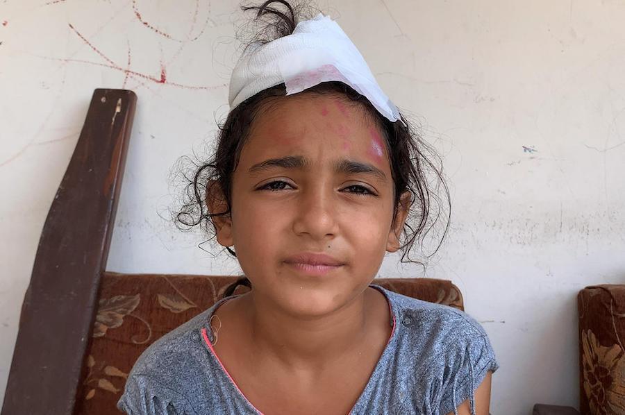 Mira, 10, was injured by the deadly explosion that rocked Beirut, Lebanon on August 4, 2020.