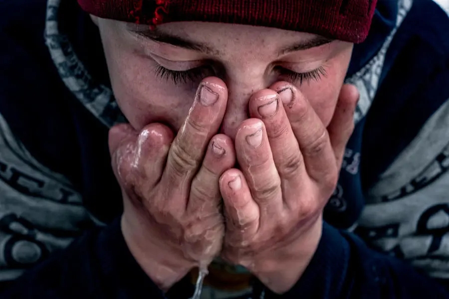 Aleksey, 14, lost a thumb and two fingers when a grenade he found exploded in his hand in Donesk Oblast, Ukraine. Aleksey, 14, lost a thumb and two fingers when a grenade he found exploded in his hand in Donesk Oblast, Ukraine.