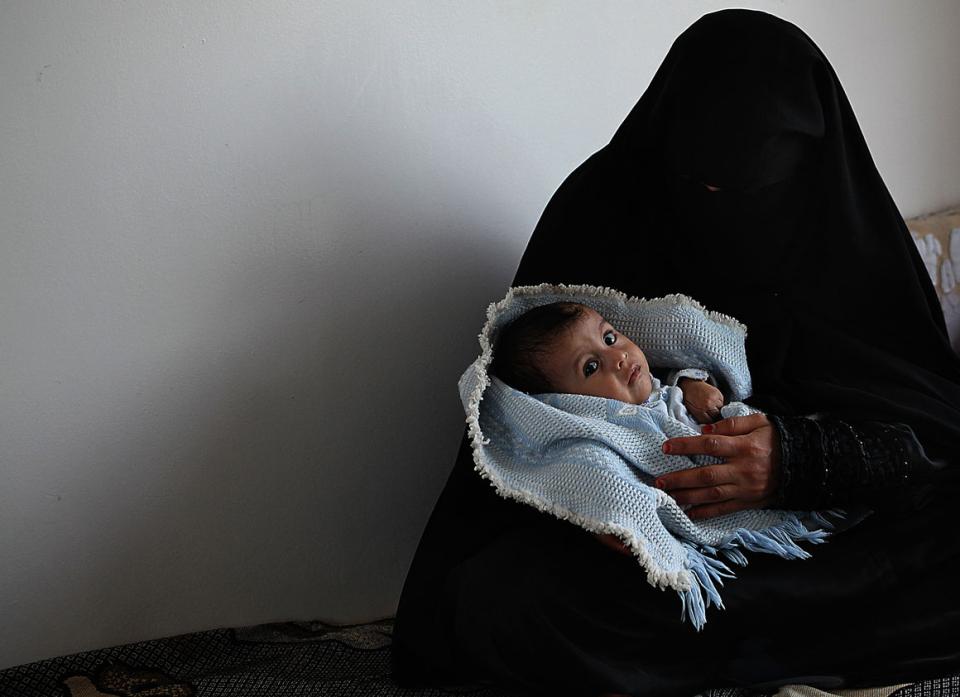 A five-month-old  is cradled by his mother, at the UNICEF-supported therapeutic feeding centre 