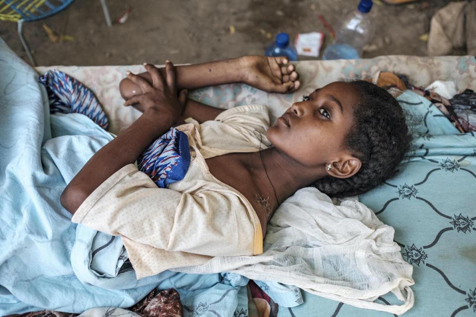 A young girl caught in the crossfire during fighting in Ethiopia's Tigray region recovers from her injuries at her home in Humera.