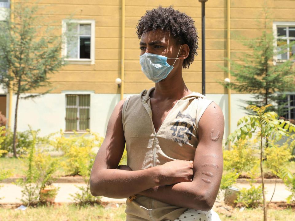 UNICEF helps unaccompanied child migrants like Berhan, 17, who left Ethiopia to find work but was captured by human traffickers in Yemen and held captive for five months. 