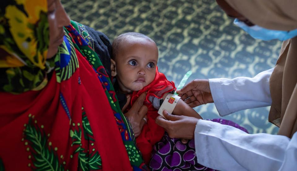 A health care worker screens 8-month-old Latu to measure the progress of her treatment for severe acute malnutrition at the UNICEF-supported Dubuluk Health Center in Ethiopia.