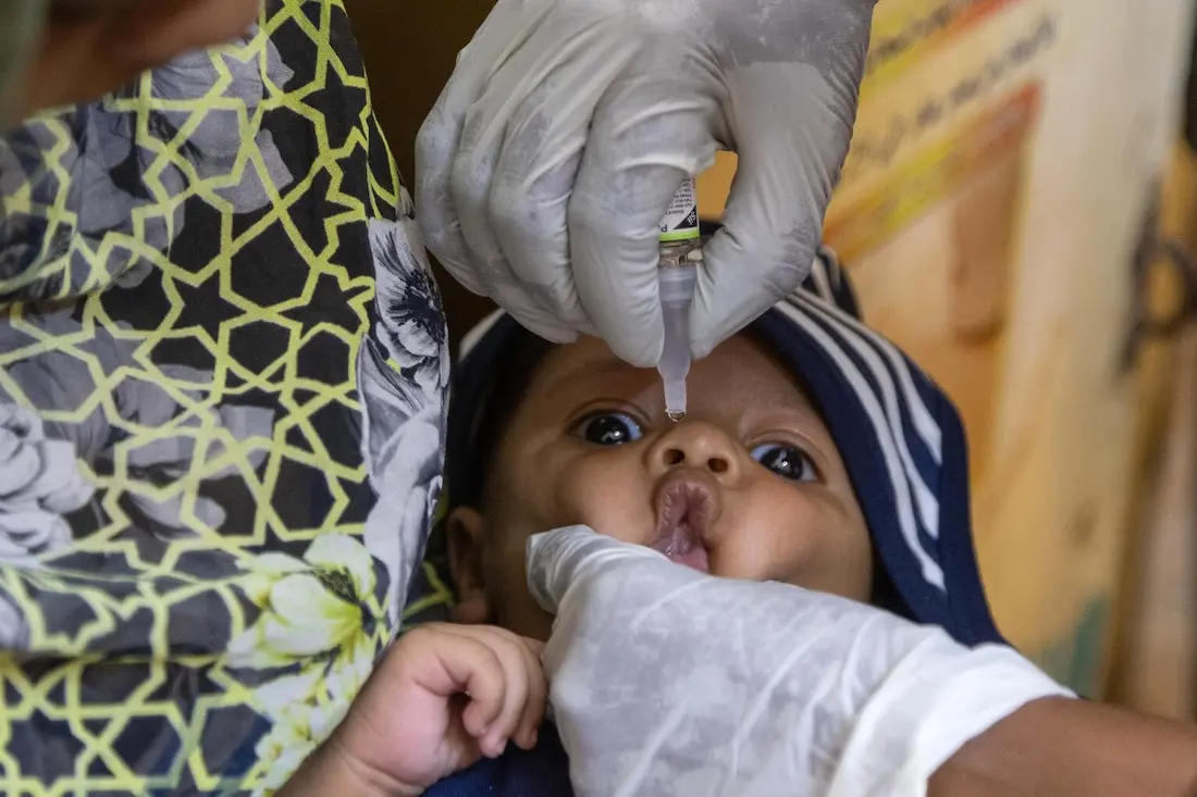 On 5 April 2025, a child receives polio drops at Saudi Hospital in Omdurman, Khartoum State, Sudan. 