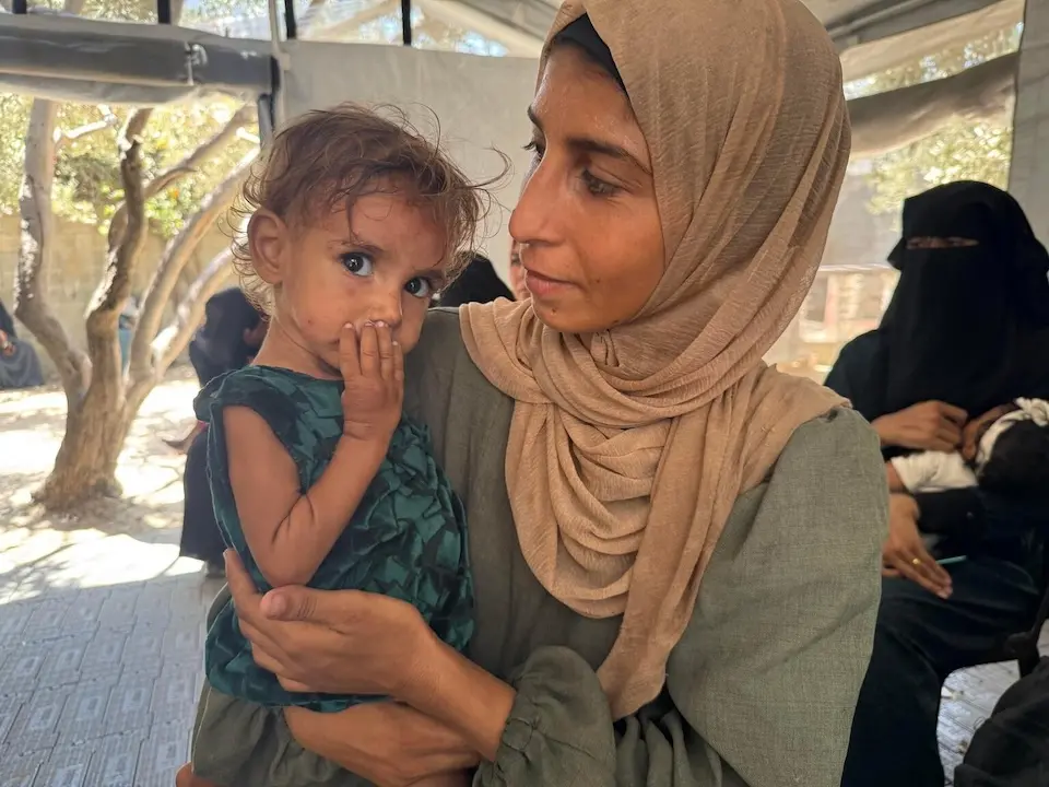 A mother holds her malnourished 14-month-old daughter in the Gaza Strip.