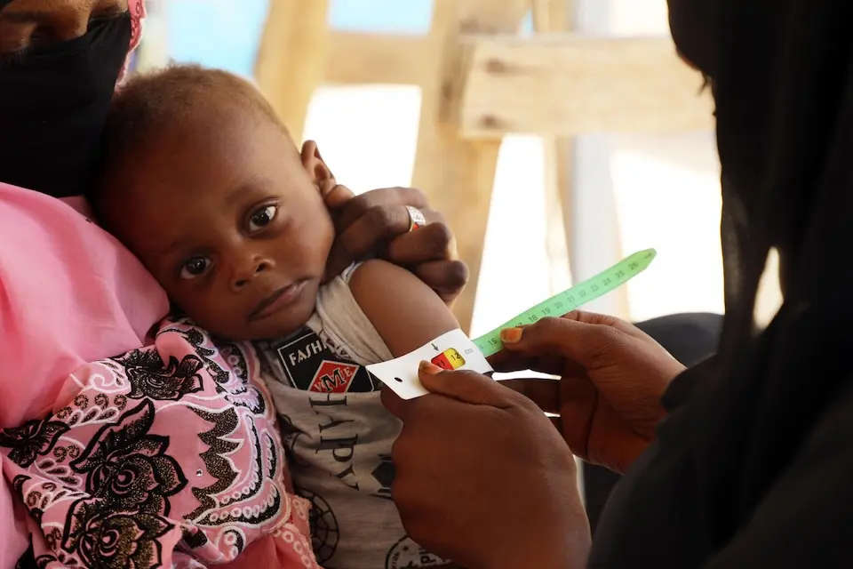 A baby is screened for malnutrition at a UNICEF-supported health facility in Tiné, Chad near the Sudanese border.