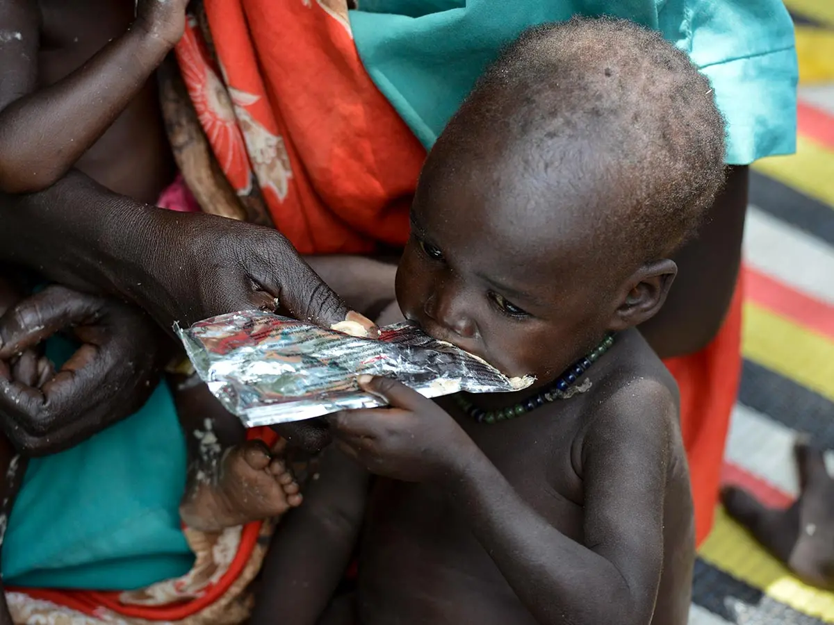 Child Eating Therapeutic Food
