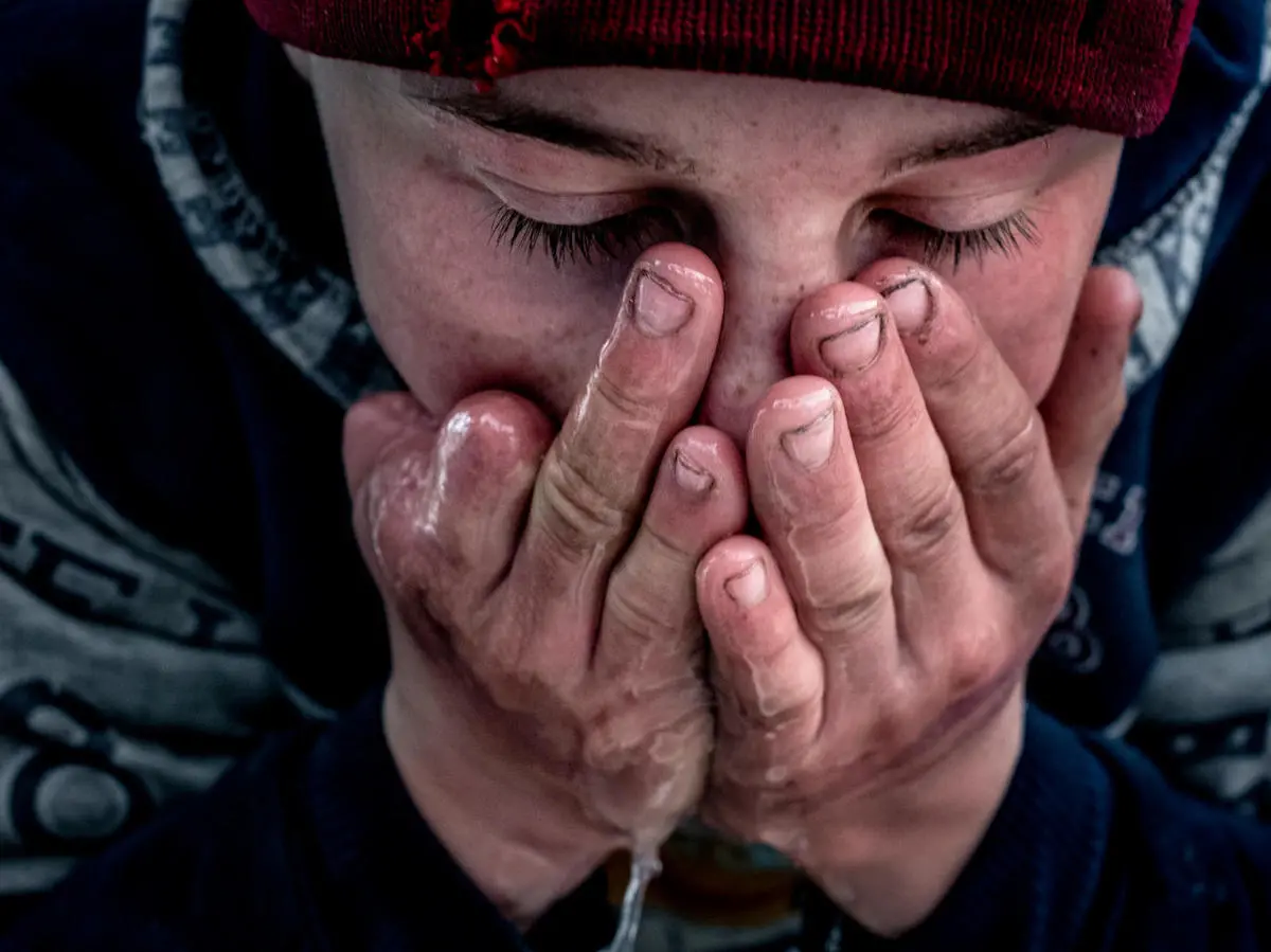 Aleksey, 14, lost a thumb and two fingers when a grenade plug he found exploded in his hand. UNICEF, Ukraine, children in conflict, kids helping kids