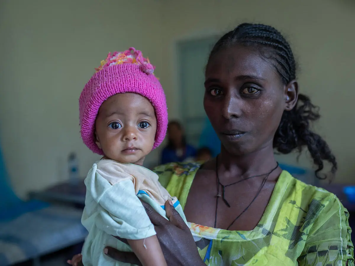 Yeshialem Gebreegziabher, 27, holds her daughter, 6-month-old Kalkidan Yeman, who is suffering from malnutrition, at Aby Adi Health Center in the Tigray region of northern Ethiopia, on June 7, 2021. Yeshialem Gebreegziabher, 27, holds her daughter, 6-month-old Kalkidan Yeman, who is suffering from malnutrition, at Aby Adi Health Center in the Tigray region of northern Ethiopia, on June 7, 2021.