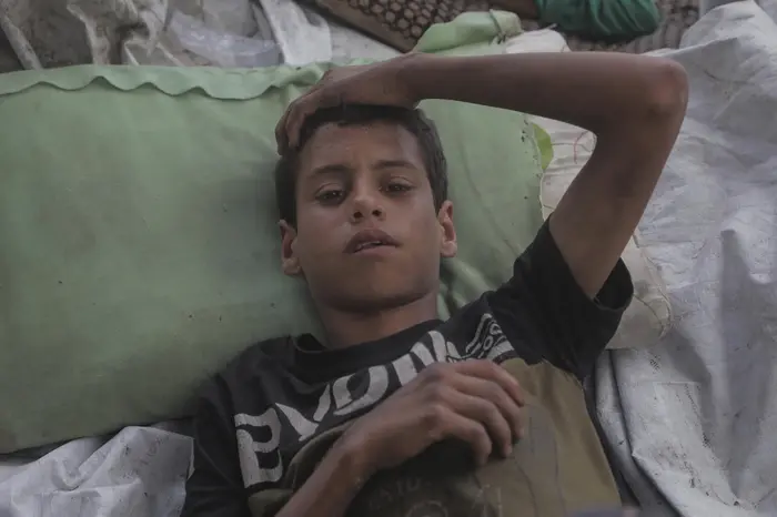 An injured boy lies with his head on a pillow in the Gaza Strip.