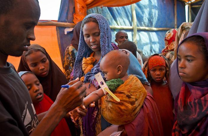 A health worker uses a mid-upper arm circumference (MUAC) band to measure a baby's arm during a UNICEF-assisted nutritional screening in the Buramino refugee camp in Ethiopia's Somali region.