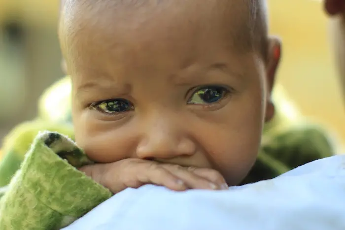 Baby Abinet is just three months old and he has pneumonia.