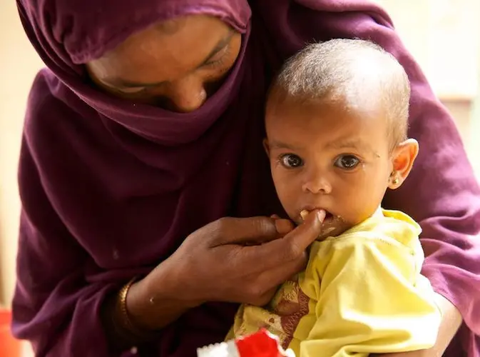 unicef, unicef usa, malnourished children, world hunger, sudan, darfur, child malnutrition