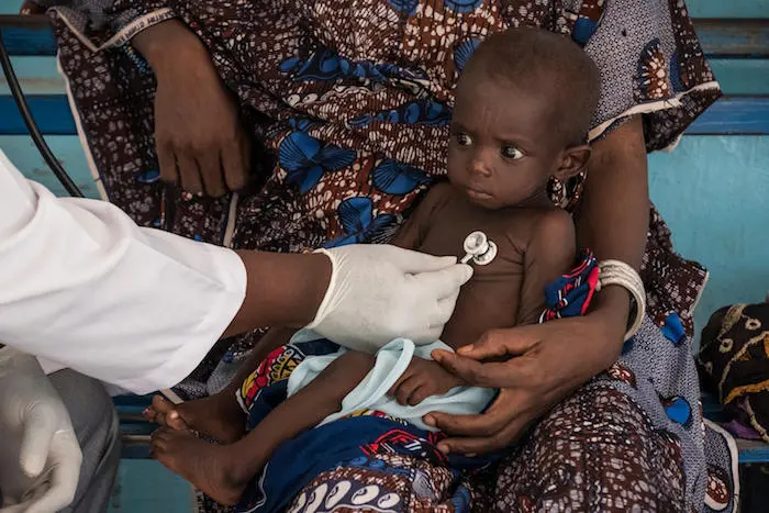 A mother brings her 2-year-old daughter, who is suffering from severe acute malnutrition, to a UNICEF-supported health center in Mopti, Mali.
