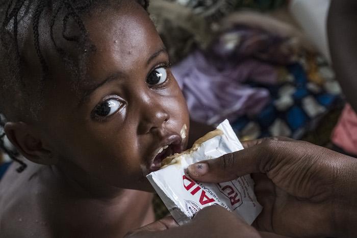 UNICEF procures 80% of the world’s Ready-to-Use Therapeutic Food (RUTF), a nutrient-packed peanut paste so effective at saving malnourished children that it’s been called “a malnutrition miracle.” Here, Mboumbou, receives treatment with RUTF, at the nutri