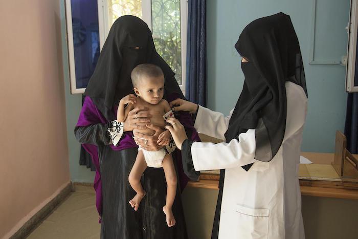 Worried parents bring their malnourished children to a UNICEF-supported therapeutic nutrition center in Hudaydah, Yemen.