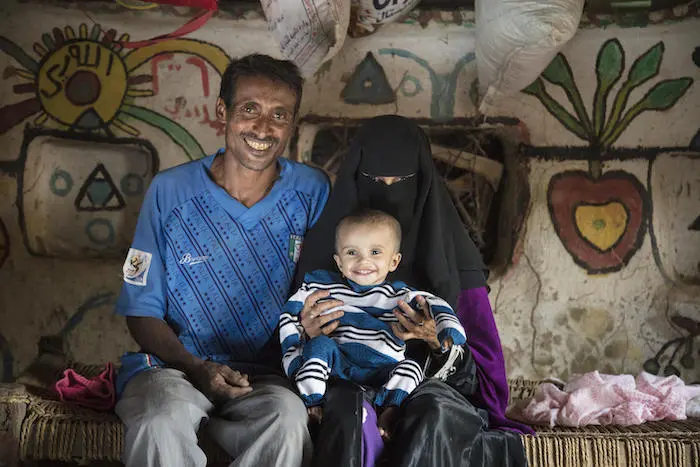 Doa'a was severely malnourished when her parents rushed her to a UNICEF-funded therapeutic nutrition center in Hudaydah, Yemen, where doctors saved her life. 