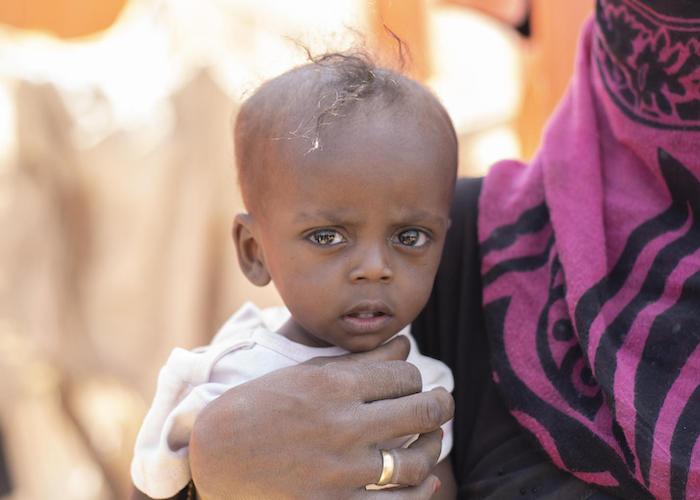 Saud Humadi, mother of five, holds her severely malnourished baby, Saeed, in a camp for internally displaced persons in Lahj governorate, southern Yemen, 2019. 