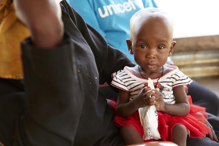 Quiet and too weak to stand, 9-month-old Amira is fed Ready-to-Use Therapeutic Food (RUTF) at a UNICEF-supported nutrition center in Gabat, South Sudan in July 2019.