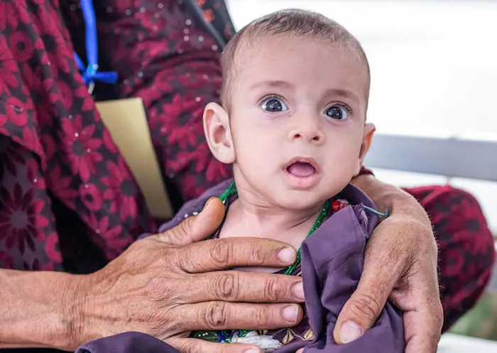 On September 28, 2021,15-month-old Javid is being treated severe acute malnutrition at the UNICEF-supported Inpatient Therapeutic Feeding Center in Herat Regional Hospital, Afghanistan.