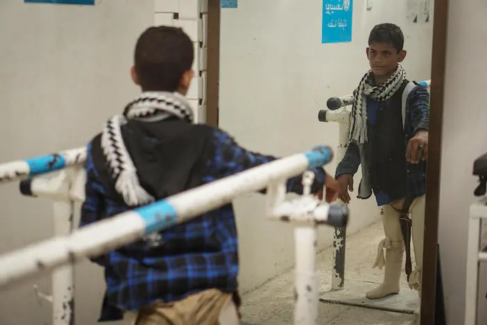 Ibrahim, gravely injured after stepping on a land mine, practices walking with a balance beam in the prosthetic center in Aden, Yemen, on Oct. 14, 2021. Ibrahim, gravely injured after stepping on a land mine, practices walking with a balance beam in the prosthetic center in Aden, Yemen, on Oct. 14, 2021.