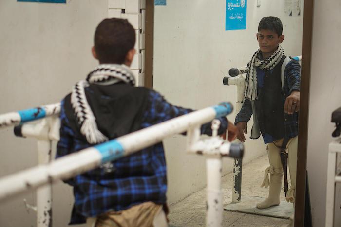 Ibrahim, gravely injured after stepping on a land mine, practices walking with a balance beam in the prosthetic center in Aden, Yemen, on Oct. 14, 2021.