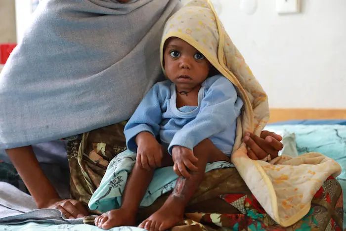 A mother sits with her child who is being treated for severe acute malnutrition at a UNICEF-supported facility in Mekelle, Tigray, Ethiopia. A mother sits with her child who is being treated for severe acute malnutrition at a UNICEF-supported facility in Mekelle, Tigray, Ethiopia.