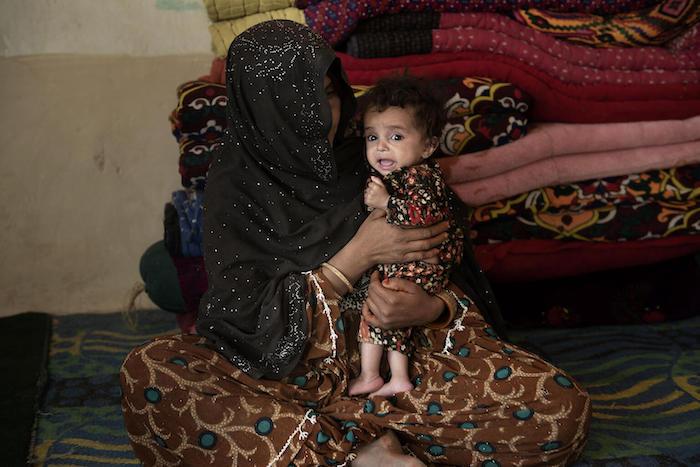 Shukuriya, 8 months old, of Kandahar, Afghanistan, suffers from severe acute malnutrition.
