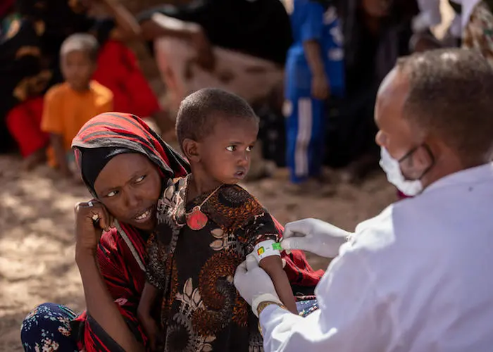 A nurse measures a 2-year-old’s arm circumference with a pediatric MUAC (Mid-Upper Arm Circumference) bracelet. She is receiving treatment for malnutrition at a UNICEF-supported mobile clinic in Barare village, Higloley Woreda, Somali, Ethiopia. A nurse measures a 2-year-old’s arm circumference with a pediatric MUAC (Mid-Upper Arm Circumference) bracelet. She is receiving treatment for malnutrition at a UNICEF-supported mobile clinic in Barare village, Higloley Woreda, Somali, Ethiopia.