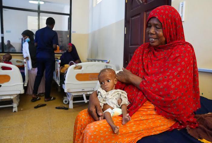 On May 25, 2022, 8-month-old Ibrahim sits on his grandmother's lap at UNICEF-supported Banadir Hospital in Mogadishu, Somalia, where he will be treated for acute malnutrition..