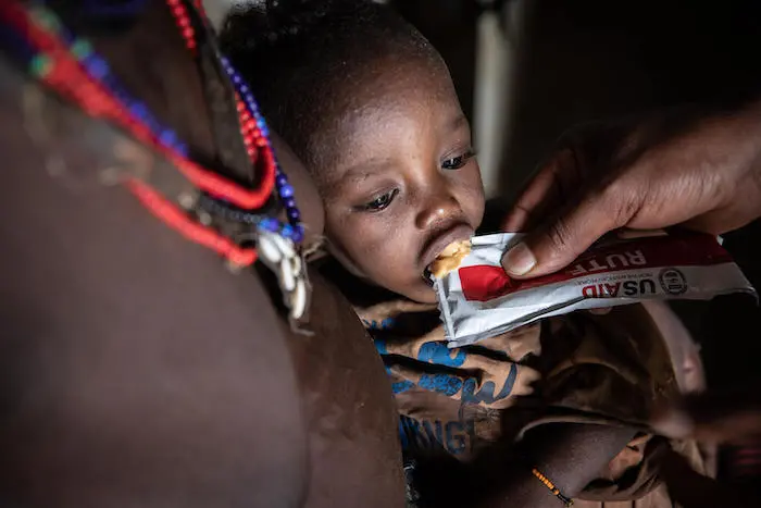 A mother treats her malnourished child with Ready-to-Use Therapeutic Food at a UNICEF-supported health post in southern Ethiopia.