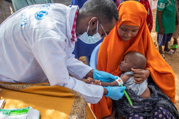 A child is screened for malnutrition by a member of a UNICEF mobile health and nutrition team at the Waffi IDP camp in Mogadishu, Somalia.