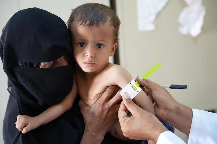 A mother holds her child as a health worker measures the boy's upper arm to screen for malnutrition at a UNICEF-supported health center in Al-khatabiah village, Lahj governorate, Yemen.