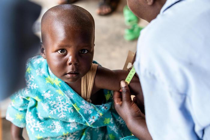 A UNICEF-supported community health worker in Gakenke District, Rwanda measures a child's mid-upper arm circumference to screen for signs of malnutrition.