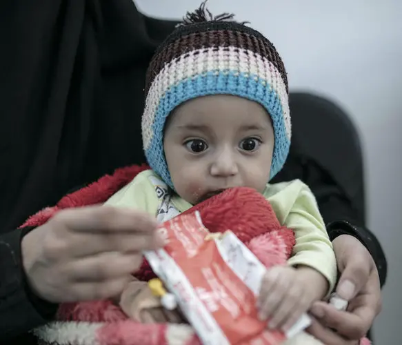 A seven-month-old baby boy recovering from severe acute malnutrition is given Ready-to-Use Therapeutic Food (RUTF).