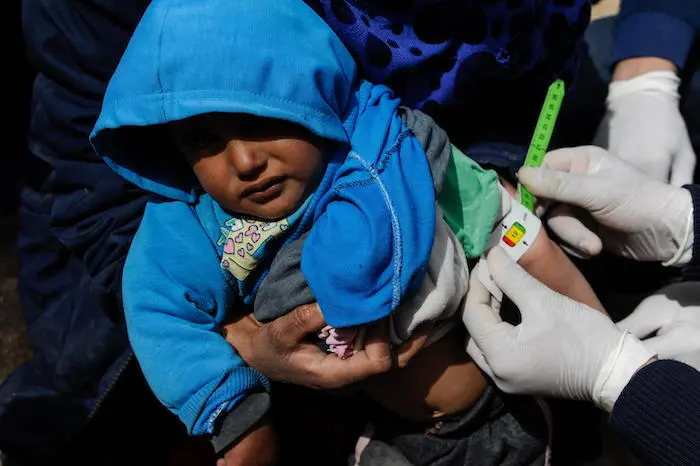 A child is screened for malnutrition at a camp for internally displaced persons in rural Ar-Raqqa, Syria. A child is screened for malnutrition at a camp for internally displaced persons in rural Ar-Raqqa, Syria.