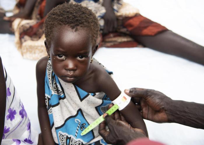 Four-year-old Koli being screened for malnutrition at a UNICEF-supported health center in Pibor, South Sudan in September 2020.