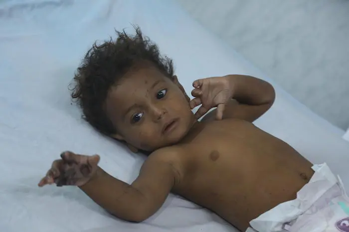 unicef, unicef usa, yemen, al hudaydah, humanitarian crisis
