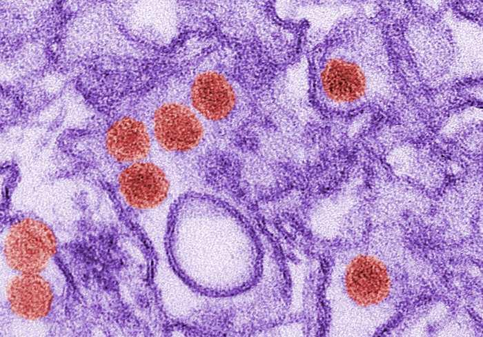 A micrograph of the Zika virus from the U.S Centers for Disease Control and Prevention (CDC)