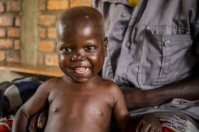 On 16 August 2018 in the Central African Republic, Pierre Mbassissi returns with his father for his follow up outpatient treatment at the Centre de Sant&eacute; Saint Joseph, on the outskirts of Bangui.