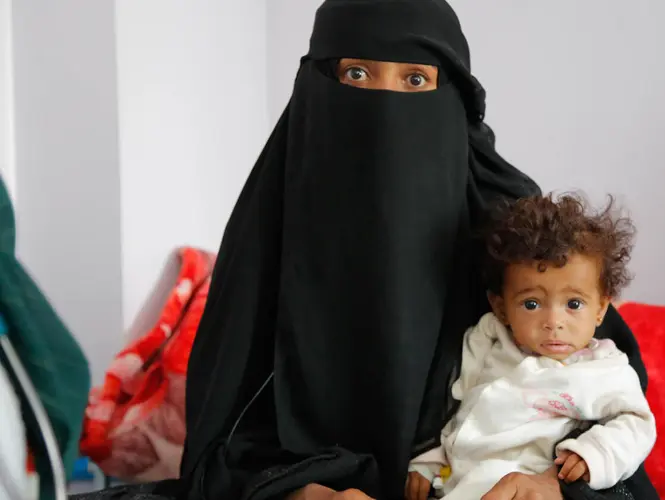 Maryam holds her 9-month-old daughter, Anisa, who is being treated for severe acute malnutrition at UNICEF-supported Hamdan Hospital, Sana&rsquo;a, Yemen on October 11, 2021.