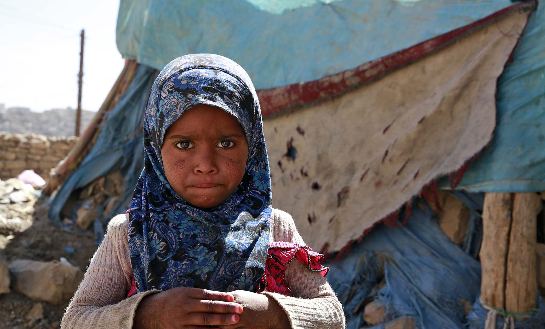 Six Ways Yemen is in Crisis - Displacement photo
